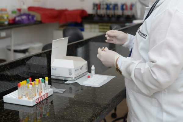 Laboratório de Palmas promete ampliar capacidade de testagem nas próximas semanas